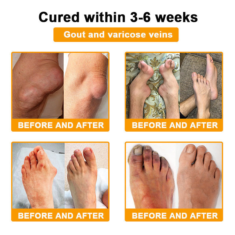 Lotmay® Bee Venom Pain Relief Joint Repair Cream 🐝🐝(Specially for older adults & FDA commends)