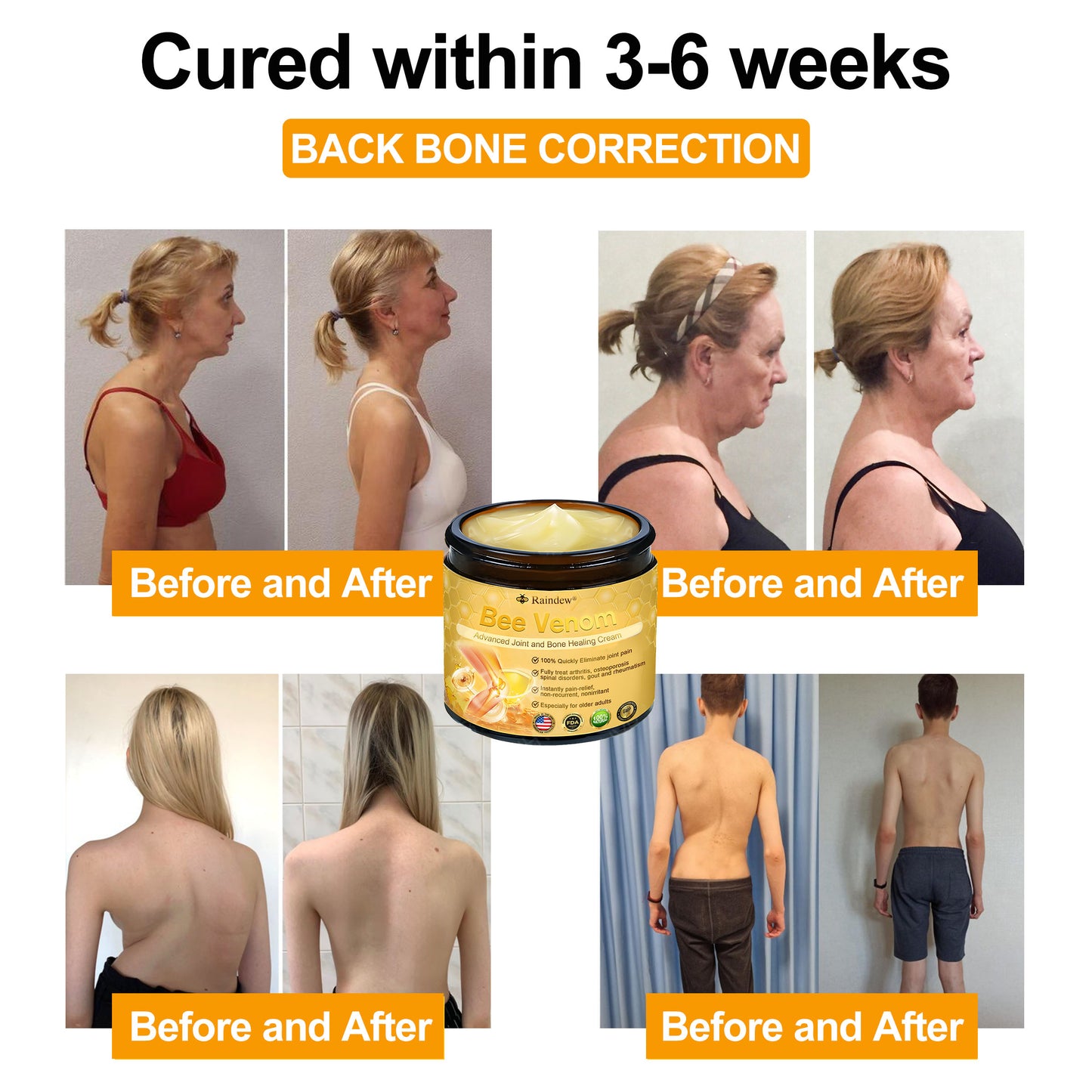 Raindew®Bee Venom Advanced Joint and Bone Healing Cream (👨⚕️Specifically developed for middle-aged and older adults)