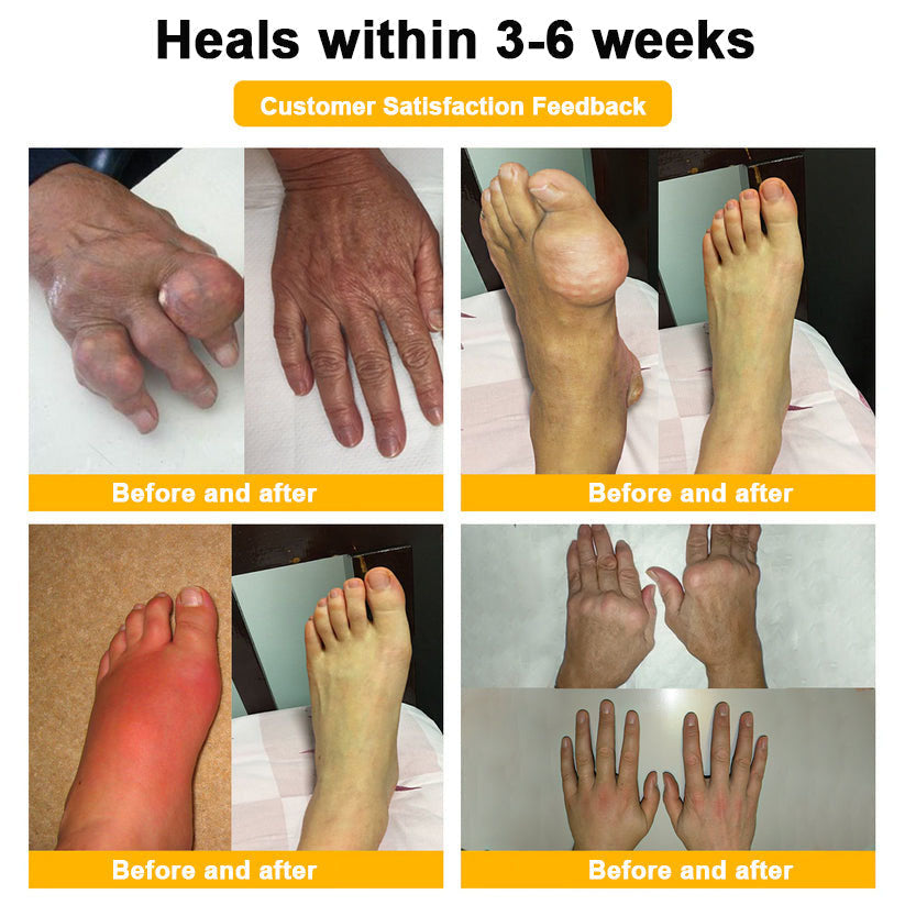 Lotmay® Bee Venom Pain Relief Joint Repair Cream 🐝🐝(Specially for older adults & FDA commends)