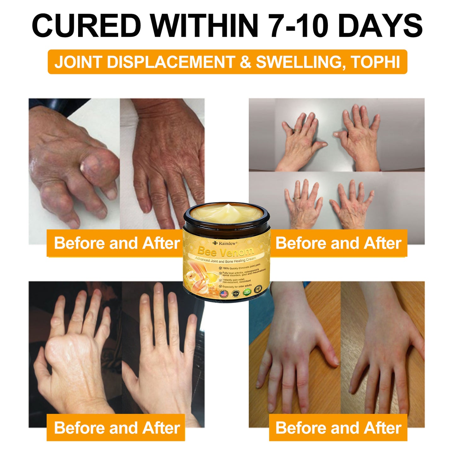 Raindew®Bee Venom Advanced Joint and Bone Healing Cream (👨⚕️Specifically developed for middle-aged and older adults)