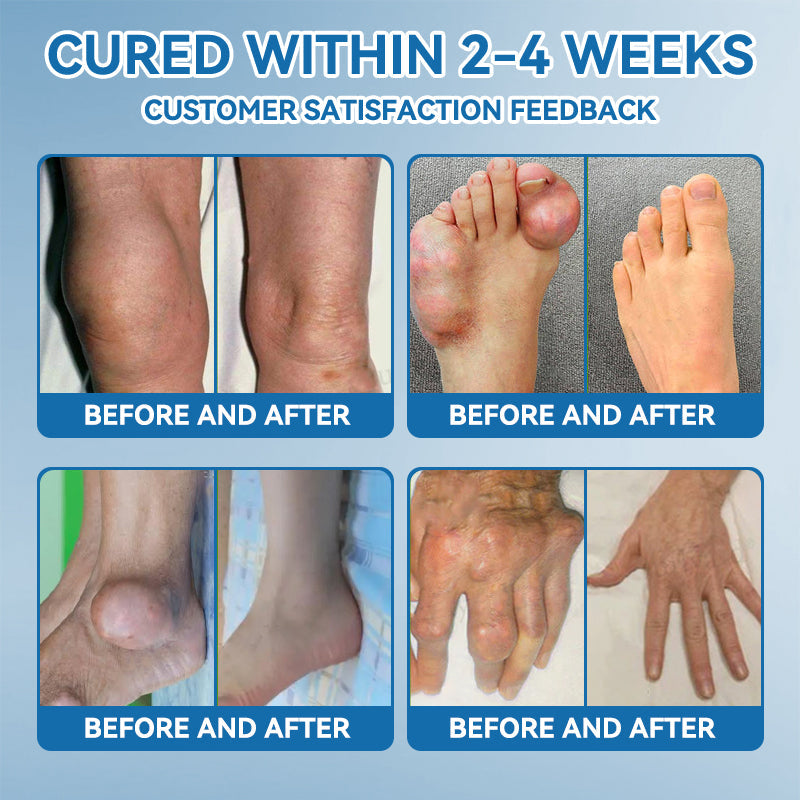 Croaie® ❤️BPC-157 Joint Healing Cream🦴Treats Arthritis, Neuropathy, Rheumatism, Sports Injuries & More🦵