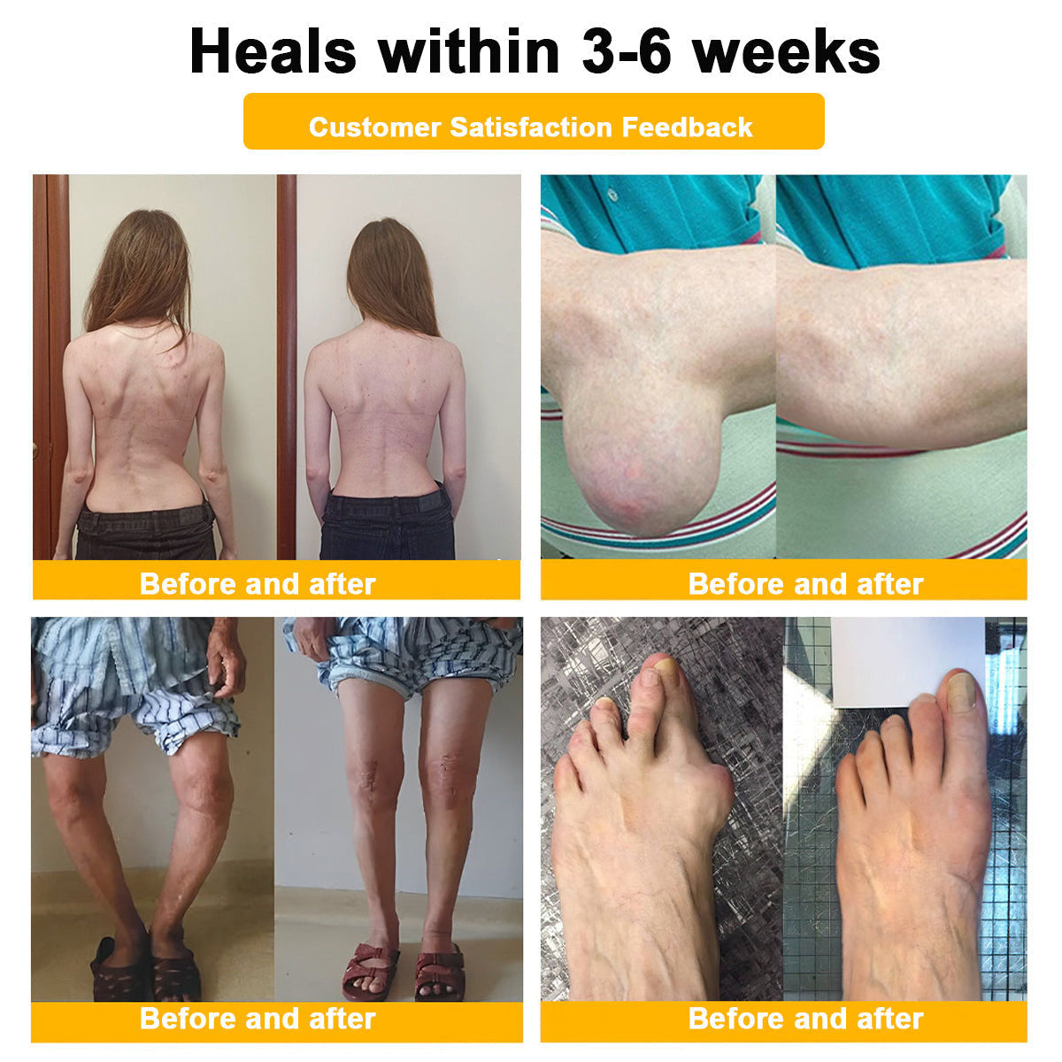 Lotmay® Bee Venom Pain Relief Joint Repair Cream 🐝🐝(Specially for older adults & FDA commends)