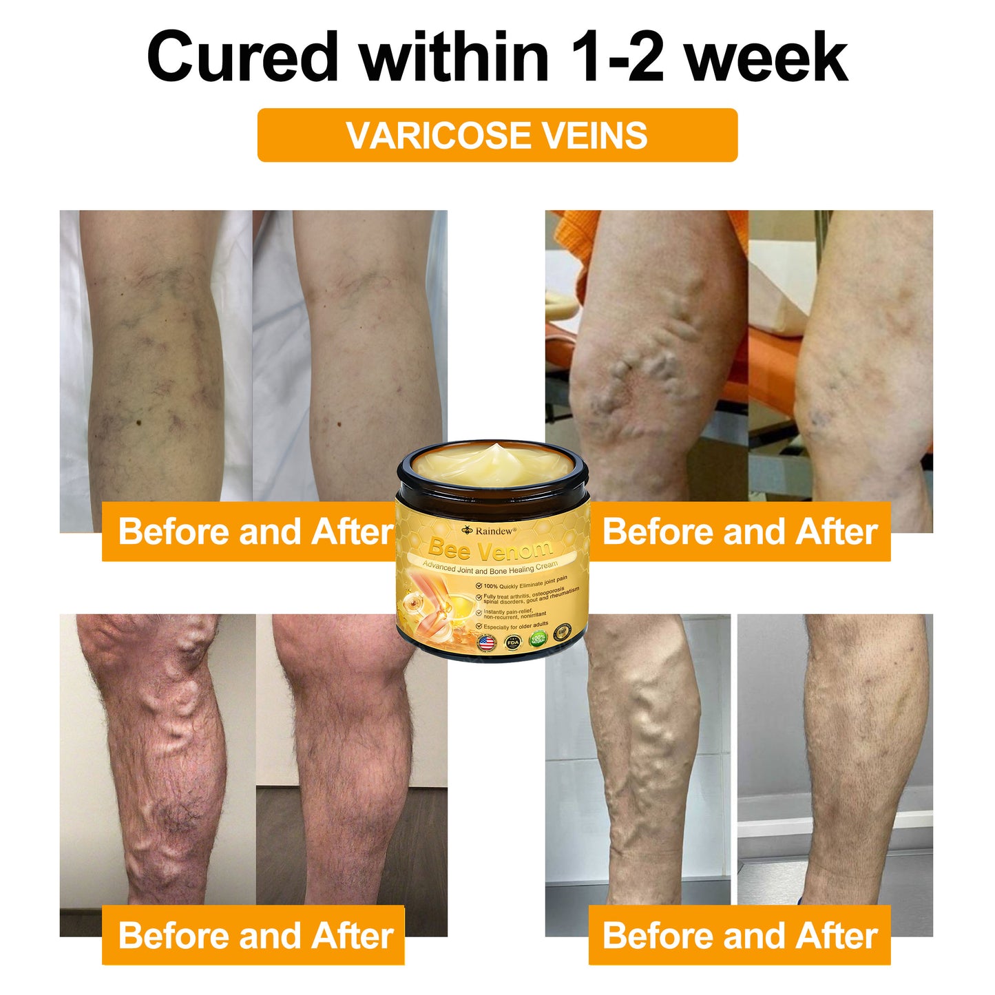 Raindew®Bee Venom Advanced Joint and Bone Healing Cream (👨⚕️Specifically developed for middle-aged and older adults)