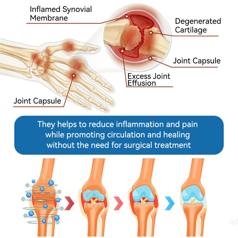 Croaie® ❤️BPC-157 Joint Healing Cream🦴Treats Arthritis, Neuropathy, Rheumatism, Sports Injuries & More🦵