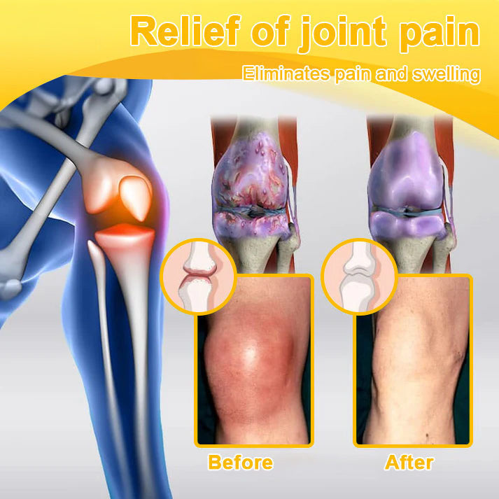 Lotmay® Bee Venom Pain Relief Joint Repair Cream 🐝🐝(Specially for older adults & FDA commends)