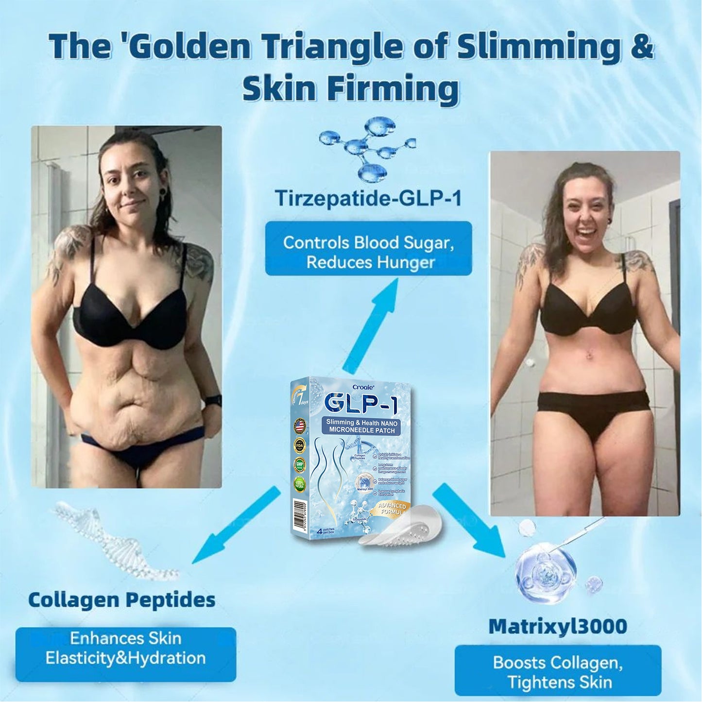 Official Store |🎁 Croaie® GLP-1 Nano-Microneedle Patch with Collagen & Matrixyl 3000丨Obesity, Cardiovascular Disease, Diabetes, Sleep Apnea, Joint Problems and More