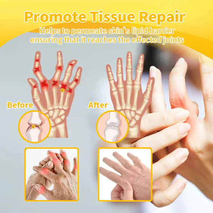 Lotmay® Bee Venom Pain Relief Joint Repair Cream 🐝🐝(Specially for older adults & FDA commends)