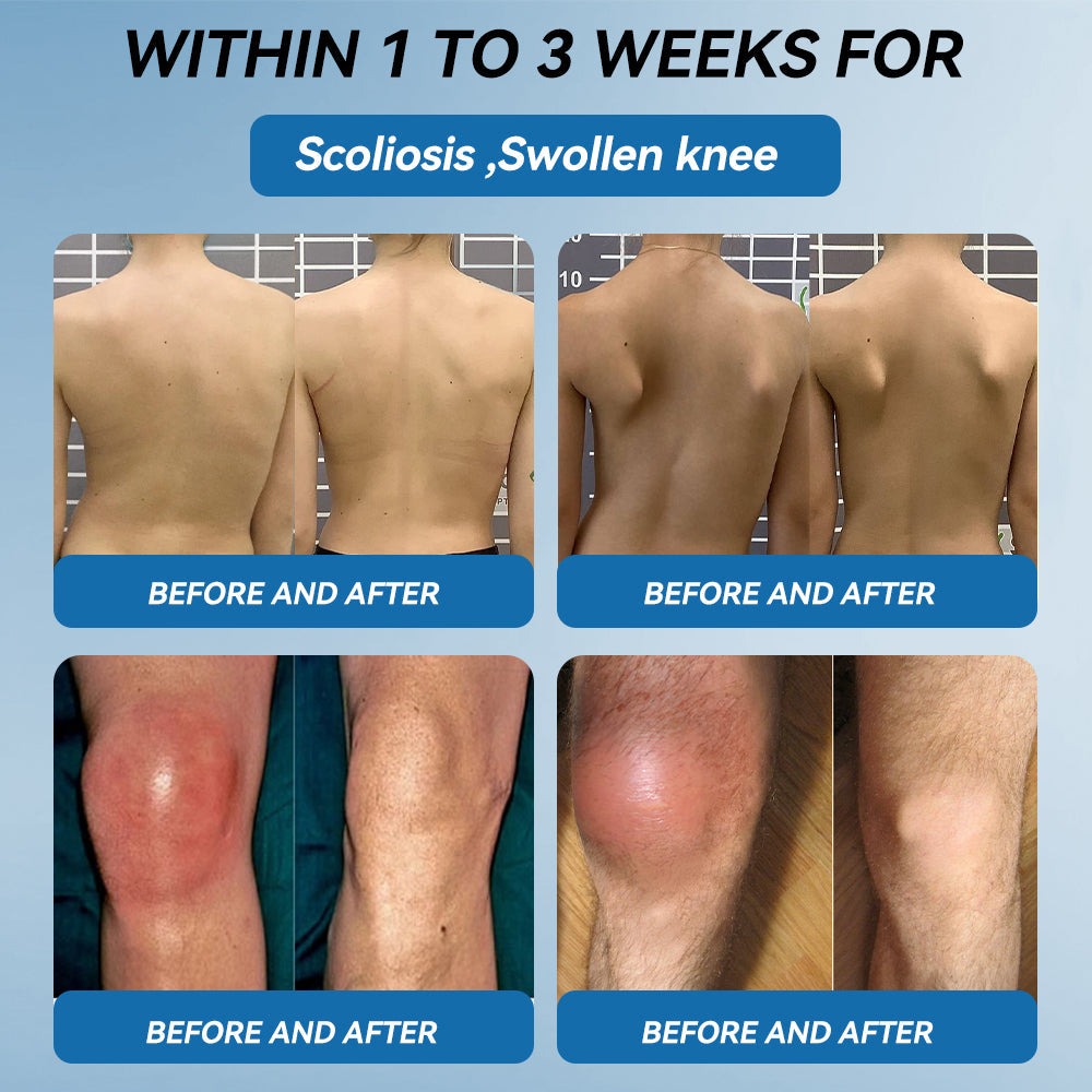 Croaie® ❤️BPC-157 Joint Healing Cream🦴Treats Arthritis, Neuropathy, Rheumatism, Sports Injuries & More🦵