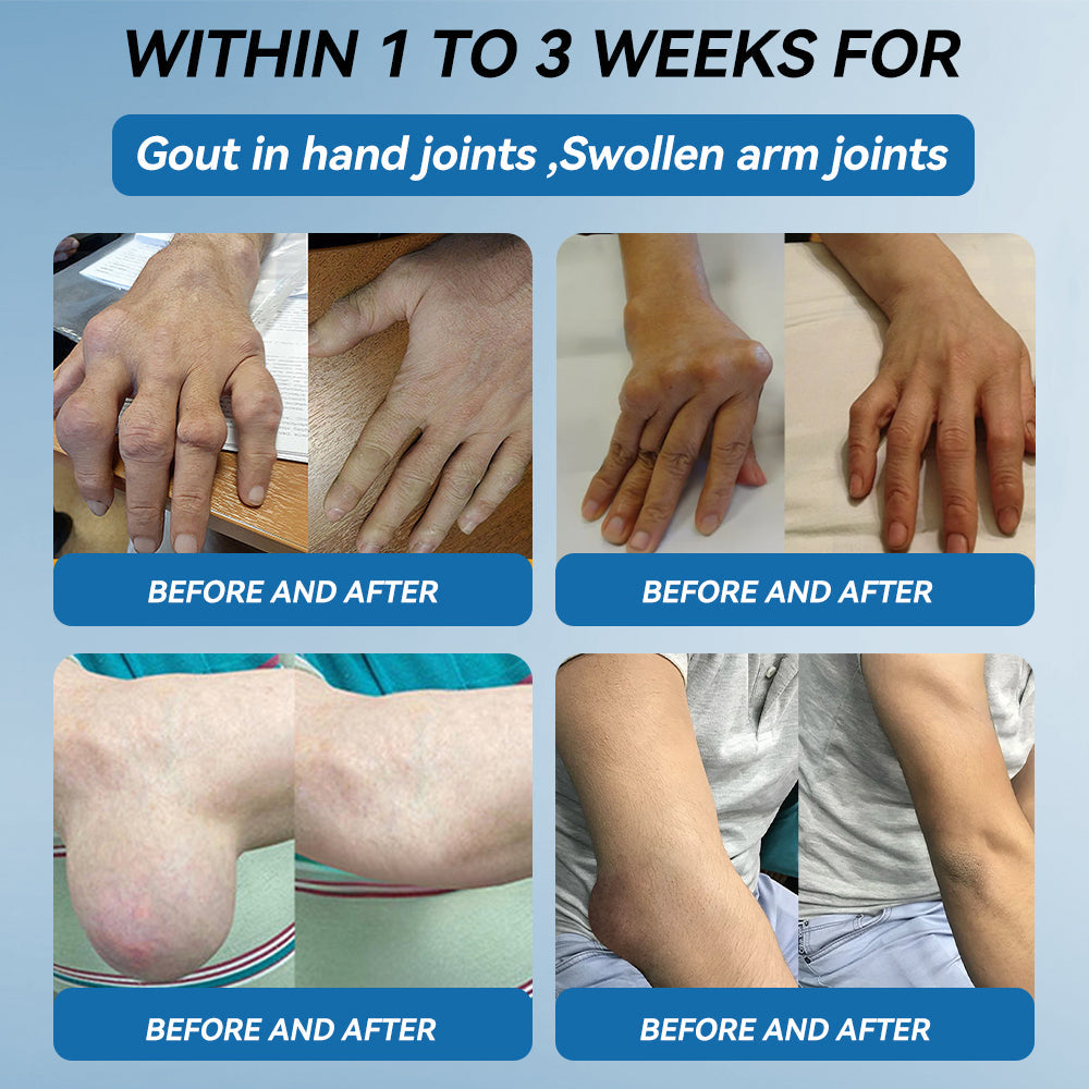 Croaie® ❤️BPC-157 Joint Healing Cream🦴Treats Arthritis, Neuropathy, Rheumatism, Sports Injuries & More🦵