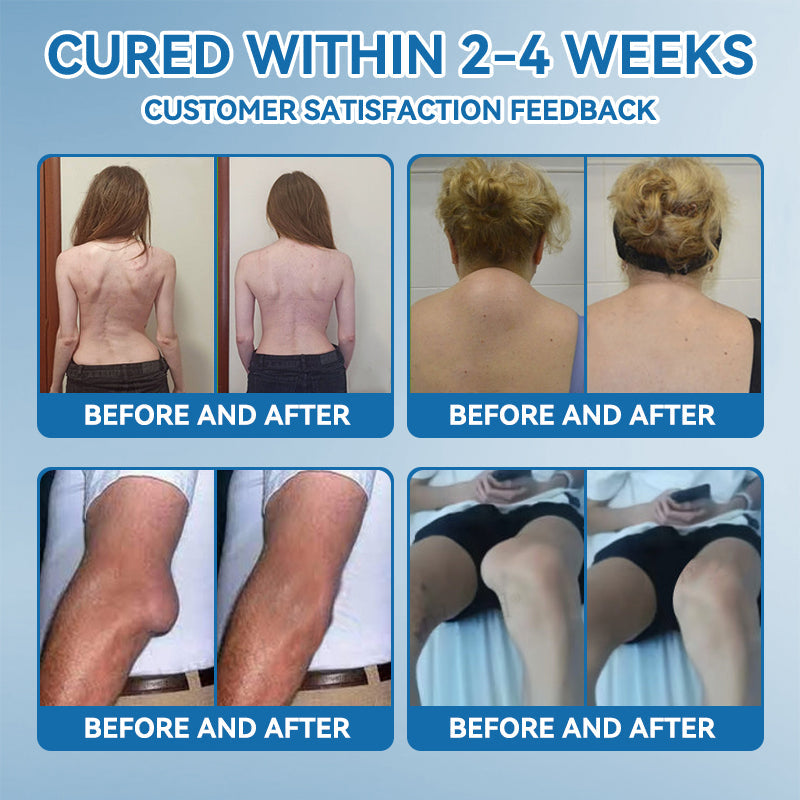 Croaie® BPC-157 Joint Healing Cream🦴Treats Arthritis, Neuropathy, Rheumatism, Sports Injuries & More🦵