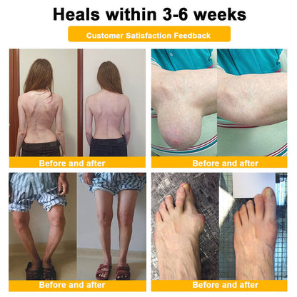 Lotmay® Bee Venom Pain Relief Joint Repair Cream 🐝🐝(Specially for older adults & FDA commends)