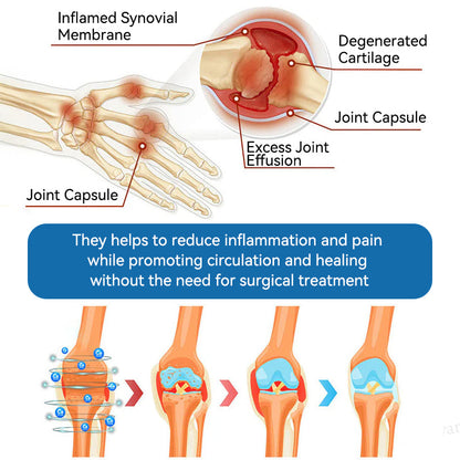 Croaie® BPC-157 Joint Healing Cream🦴Treats Arthritis, Neuropathy, Rheumatism, Sports Injuries & More🦵