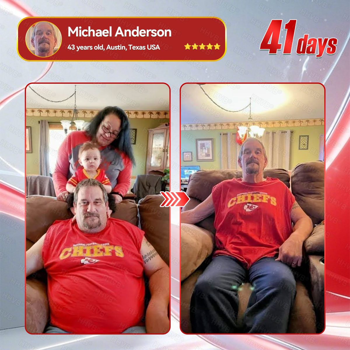 🇺🇸𝑶𝒇𝒇𝒊𝒄𝒊𝒂𝒍 𝑺𝒕𝒐𝒓𝒆𝑰𝐻𝐻𝑉𝐵®🍓𝑮𝑳𝑷-1+𝑪𝒐𝒍𝒍𝒂𝒈𝒆𝒏 𝑷𝒆𝒑𝒕𝒊𝒅𝒆𝒔 𝑾𝒆𝒊𝒈𝒉𝒕 𝑳𝒐𝒔𝒔&𝑭𝒊𝒓𝒎𝒊𝒏𝒈 𝑶𝒓𝒂𝒍 𝑺𝒐𝒍𝒖𝒕𝒊𝒐𝒏 𝒘𝒊𝒕𝒉 🔥𝑪𝒐𝒍𝒍𝒂𝒈𝒆𝒏 𝑷𝒆𝒑𝒕𝒊𝒅𝒆𝒔 & 𝑴𝒂𝒕𝒓𝒊𝒙𝒚𝒍 3000 𝒉𝒆𝒍𝒑𝒔 𝒕𝒂𝒓𝒈𝒆𝒕 ✅𝒐𝒃𝒆𝒔𝒊𝒕𝒚, 𝒇𝒊𝒓𝒎𝒔 𝒔𝒌𝒊𝒏,𝒄𝒂𝒓𝒅𝒊𝒐𝒗𝒂𝒔𝒄𝒖𝒍𝒂𝒓 𝒅𝒊𝒔𝒆𝒂𝒔𝒆, 𝒅𝒊𝒂𝒃𝒆𝒕𝒆𝒔, 𝒔𝒍𝒆𝒆𝒑 𝒂𝒑𝒏𝒆𝒂, 𝒋𝒐𝒊𝒏𝒕 𝒑𝒓𝒐𝒃𝒍𝒆𝒎𝒔, 𝒂𝒏𝒅 𝒎𝒐𝒓𝒆,