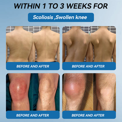 Croaie® BPC-157 Joint Healing Cream🦴Treats Arthritis, Neuropathy, Rheumatism, Sports Injuries & More🦵