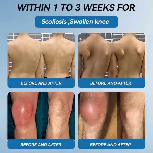Croaie"®🇺🇸 𝐁𝐏𝐂-𝟏𝟓𝟕 𝐉𝐨𝐢𝐧𝐭 𝐇𝐞𝐚𝐥𝐢𝐧𝐠 Capsules, 1000MG, Non-GMO, Gluten-Free, 60 Capsules🦴Treats Arthritis, Neuropathy, Rheumatism, Sports Injuries & More🏆