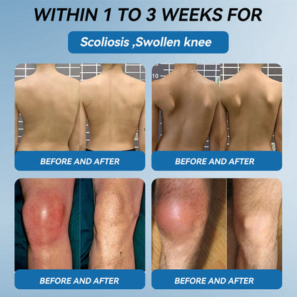 Croaie"®🇺🇸 𝐁𝐏𝐂-𝟏𝟓𝟕 𝐉𝐨𝐢𝐧𝐭 𝐇𝐞𝐚𝐥𝐢𝐧𝐠 Capsules, 1000MG, Non-GMO, Gluten-Free, 60 Capsules🦴Treats Arthritis, Neuropathy, Rheumatism, Sports Injuries & More🏆