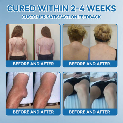 Croaie"®🇺🇸 𝐁𝐏𝐂-𝟏𝟓𝟕 𝐉𝐨𝐢𝐧𝐭 𝐇𝐞𝐚𝐥𝐢𝐧𝐠 Capsules, 1000MG, Non-GMO, Gluten-Free, 60 Capsules🦴Treats Arthritis, Neuropathy, Rheumatism, Sports Injuries & More🏆