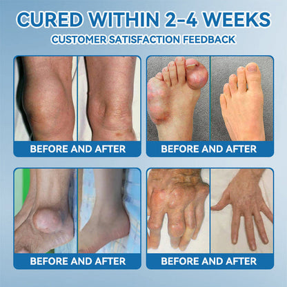 Croaie"®🇺🇸 𝐁𝐏𝐂-𝟏𝟓𝟕 𝐉𝐨𝐢𝐧𝐭 𝐇𝐞𝐚𝐥𝐢𝐧𝐠 Capsules, 1000MG, Non-GMO, Gluten-Free, 60 Capsules🦴Treats Arthritis, Neuropathy, Rheumatism, Sports Injuries & More🏆