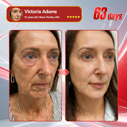 🇺🇸𝑶𝒇𝒇𝒊𝒄𝒊𝒂𝒍 𝑺𝒕𝒐𝒓𝒆𝑰𝐻𝐻𝑉𝐵®🍓𝑮𝑳𝑷-1+𝑪𝒐𝒍𝒍𝒂𝒈𝒆𝒏 𝑷𝒆𝒑𝒕𝒊𝒅𝒆𝒔 𝑾𝒆𝒊𝒈𝒉𝒕 𝑳𝒐𝒔𝒔&𝑭𝒊𝒓𝒎𝒊𝒏𝒈 𝑶𝒓𝒂𝒍 𝑺𝒐𝒍𝒖𝒕𝒊𝒐𝒏 𝒘𝒊𝒕𝒉 🔥𝑪𝒐𝒍𝒍𝒂𝒈𝒆𝒏 𝑷𝒆𝒑𝒕𝒊𝒅𝒆𝒔 & 𝑴𝒂𝒕𝒓𝒊𝒙𝒚𝒍 3000 𝒉𝒆𝒍𝒑𝒔 𝒕𝒂𝒓𝒈𝒆𝒕 ✅𝒐𝒃𝒆𝒔𝒊𝒕𝒚, 𝒇𝒊𝒓𝒎𝒔 𝒔𝒌𝒊𝒏,𝒄𝒂𝒓𝒅𝒊𝒐𝒗𝒂𝒔𝒄𝒖𝒍𝒂𝒓 𝒅𝒊𝒔𝒆𝒂𝒔𝒆, 𝒅𝒊𝒂𝒃𝒆𝒕𝒆𝒔, 𝒔𝒍𝒆𝒆𝒑 𝒂𝒑𝒏𝒆𝒂, 𝒋𝒐𝒊𝒏𝒕 𝒑𝒓𝒐𝒃𝒍𝒆𝒎𝒔, 𝒂𝒏𝒅 𝒎𝒐𝒓𝒆,